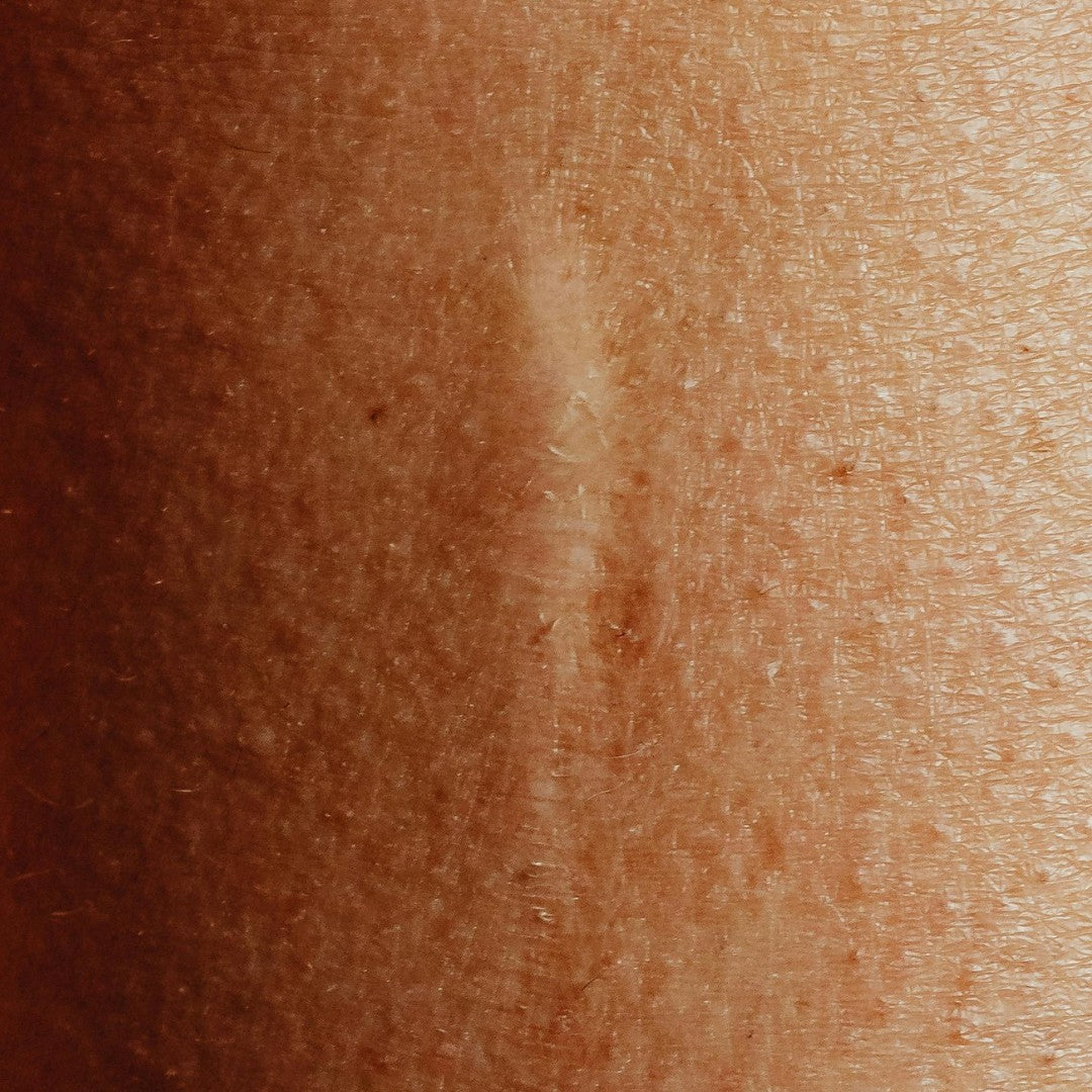 Image of a scar on skin \ Adashiko Collagen | 100% Natural Skincare